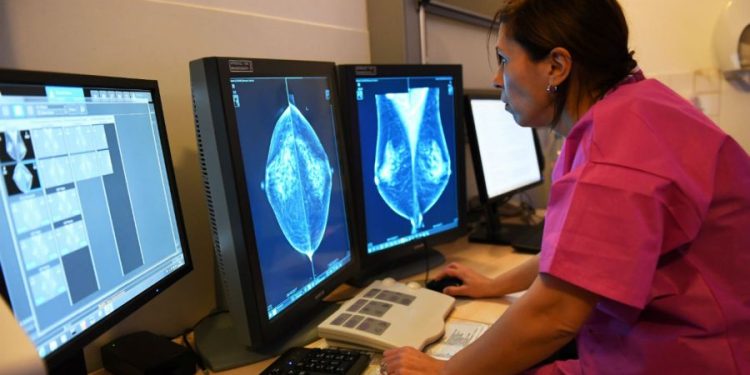 Task force now recommends breast cancer screenings start at age 40
