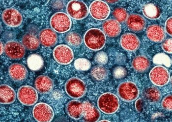 Elevated mpox cases spur efforts to avoid summer spread