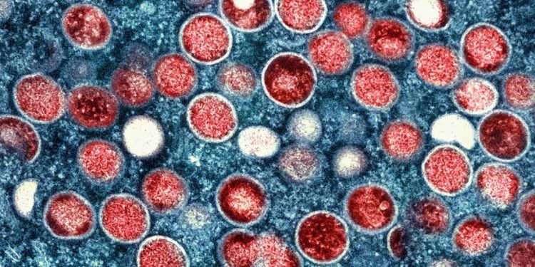 Elevated mpox cases spur efforts to avoid summer spread