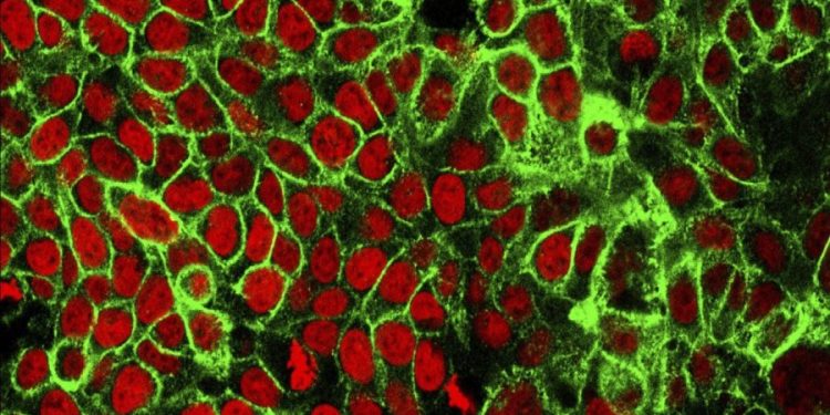 Why younger adults are missing early signs of colon cancer