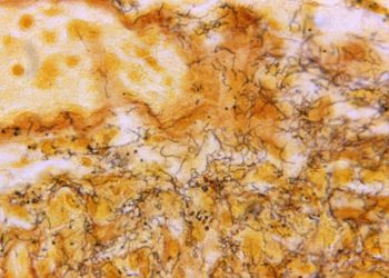 STI infection increase a ‘major concern’ for health officials: WHO