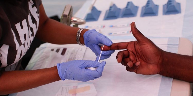 Male HIV infections dropped by 12 percent in 2022: CDC