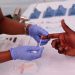 Male HIV infections dropped by 12 percent in 2022: CDC