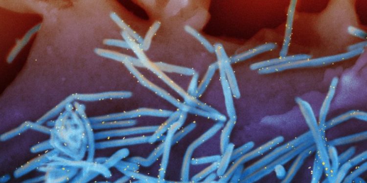 CDC issues simplified RSV vaccine guidance for seniors