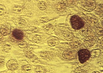 STD diagnoses jumped in recent years, especially among seniors