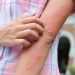 What to know about the mosquito virus spreading through New England