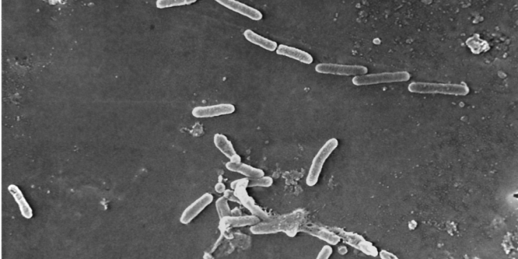 Superbugs could kill 40 million by 2050: Research