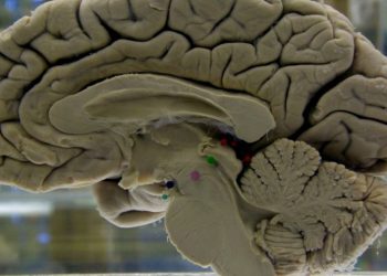 Scans show reorganization of brain during pregnancy
