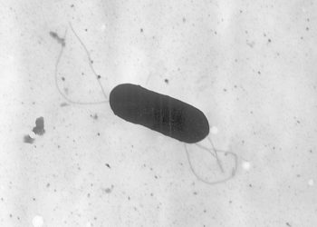 USDA lists over 150 schools that may be affected by listeria recall