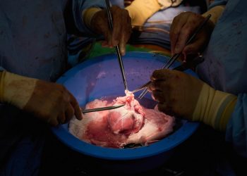 Surgeons implant new kind of engineered pig kidney