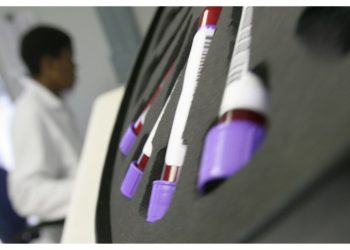 Trump aid freeze disrupts global HIV/AIDS fight