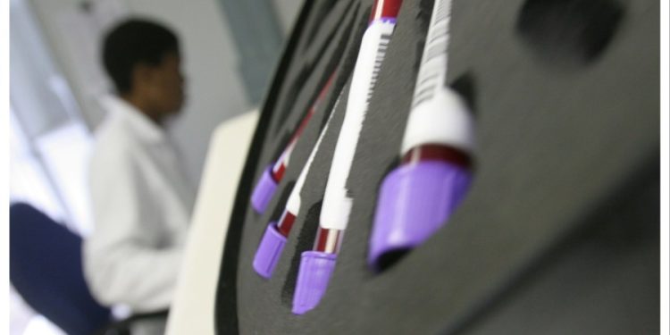 Trump aid freeze disrupts global HIV/AIDS fight