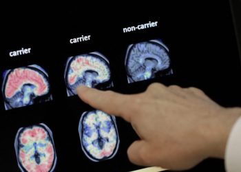 FDA clears first blood test to reliably predict Alzheimer’s disease