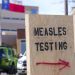 Canada has 3 times as many measles cases as US