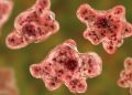 Brain-eating amoeba: Who is most often infected?