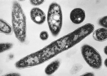 Legionnaires’ outbreak grows: What are the disease’s first symptoms?