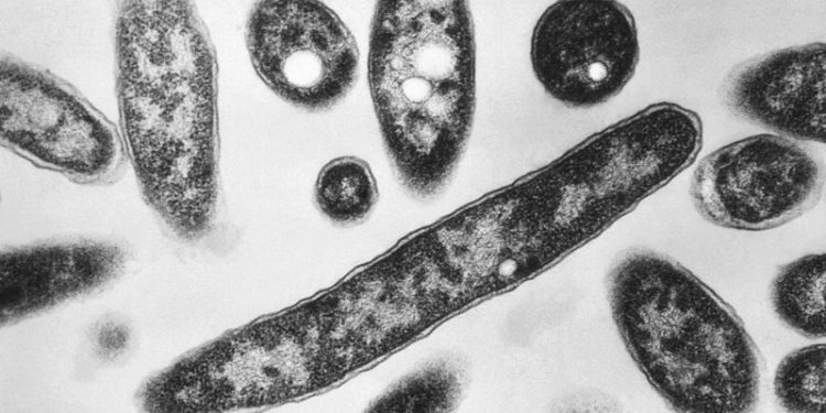 Legionnaires’ outbreak grows: What are the disease’s first symptoms?