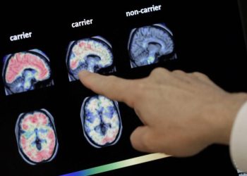 GLP-1s fail to slow progression of Alzheimer’s: Novo Nordisk