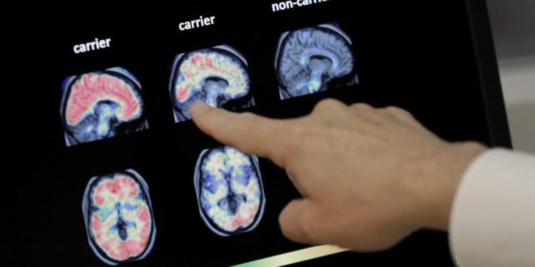 GLP-1s fail to slow progression of Alzheimer’s: Novo Nordisk