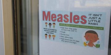 Measles case confirmed in Wisconsin