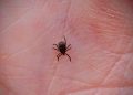 Tick bites causing highest rate of ER visits in a decade: CDC
