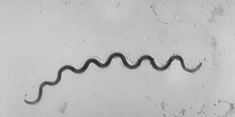 Syphilis making a comeback, health officials warn. CDC map shows where risk is highest