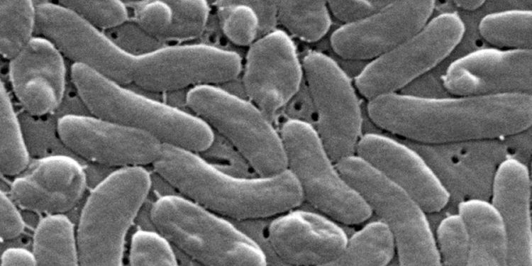 Vibrio season is here: How can you avoid the flesh-eating bacterial infection?