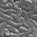 Vibrio season is here: How can you avoid the flesh-eating bacterial infection?