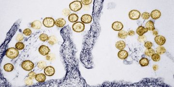 What causes hantavirus in the US?