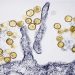 Hantavirus: Where the rare, sometimes deadly disease has been found in the US