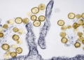 Fatal Colorado hantavirus case not linked to cruise ship, officials say