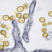 Fatal Colorado hantavirus case not linked to cruise ship, officials say