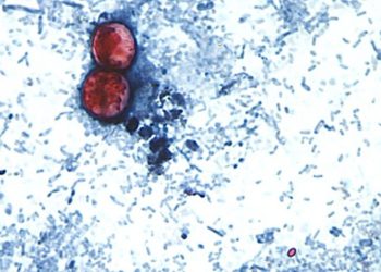 Another cyclospora outbreak not linked to lettuce under investigation: FDA