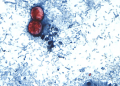 Cyclospora cases mounting in Michigan