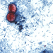 Cyclospora cases mounting in Michigan