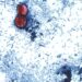 Cyclospora outbreaks with no confirmed sources grow: FDA