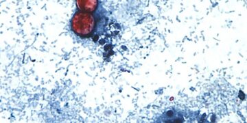 Why cyclospora can be deadly for some people