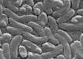 Death toll from flesh-eating bacteria rises: These are the Vibrio warning signs to watch for