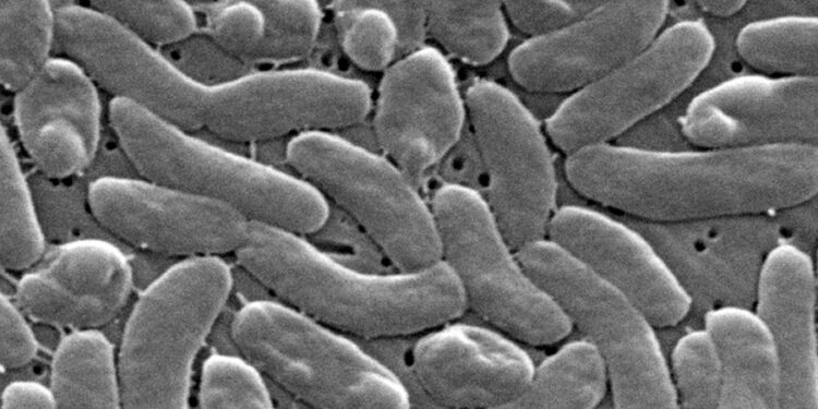 Death toll from flesh-eating bacteria rises: These are the Vibrio warning signs to watch for