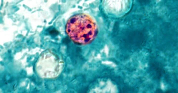 Yet another cyclosporiasis outbreak appears as cases linked to recalled lettuce grow
