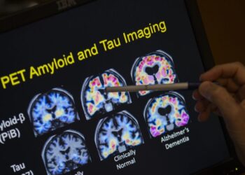 Naturally occurring human peptide shows promise against Alzheimer’s