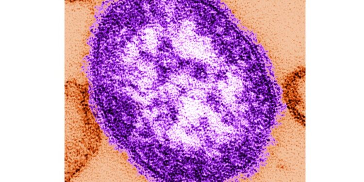 Pennsylvania reports sixth measles death